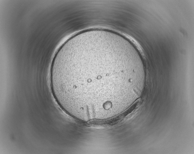 X0000115631199200912011434