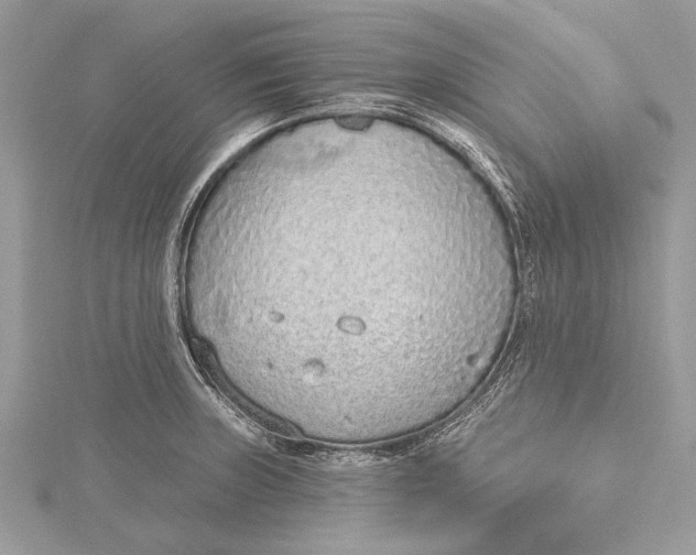 X0000115631235200912011433