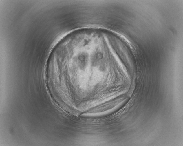 X0000115631279200912011433