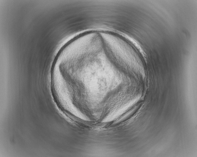 X0000115631335200912011432