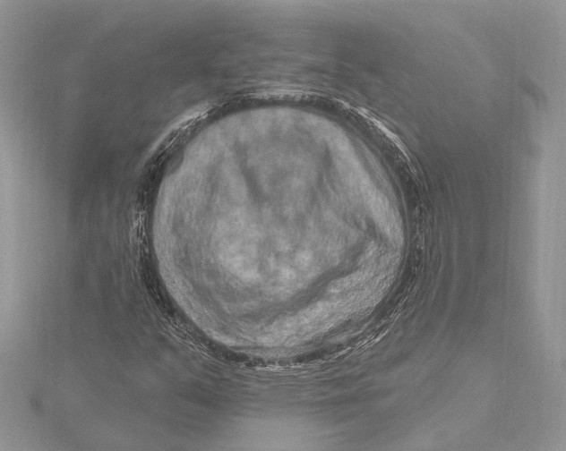 X0000115631351200912011432