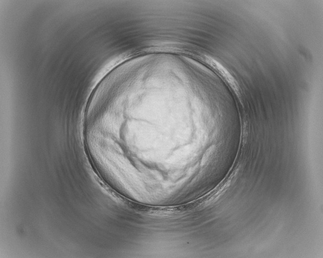 X0000115631386200912011431