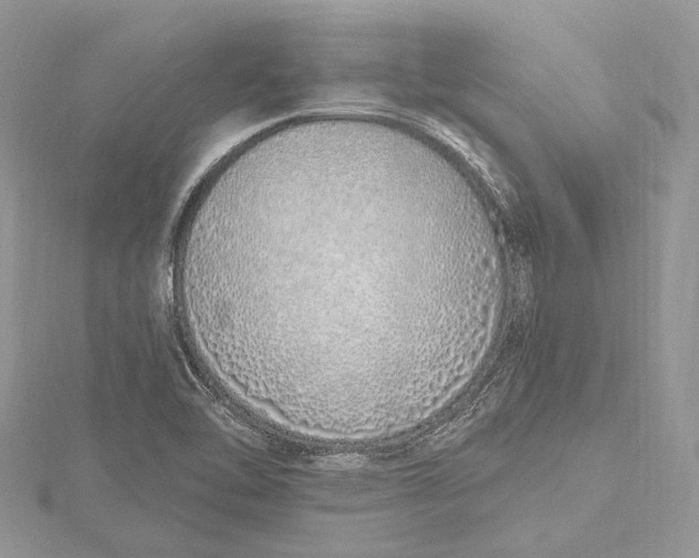 X0000115631462200912011430