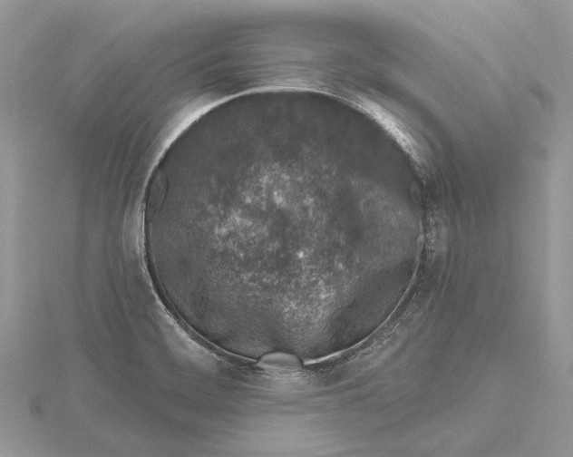 X0000115631468200912011430