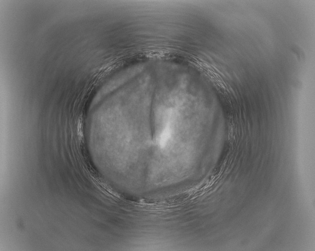 X0000115631106200912081037