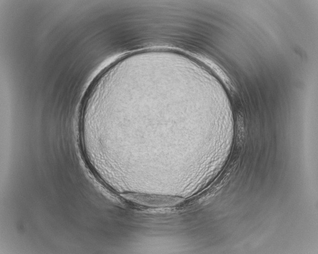 X0000115631142200912081038