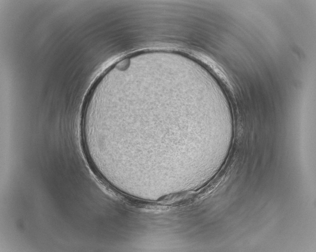 X0000115631237200912081037