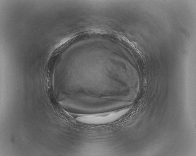 X0000115631303200912081035