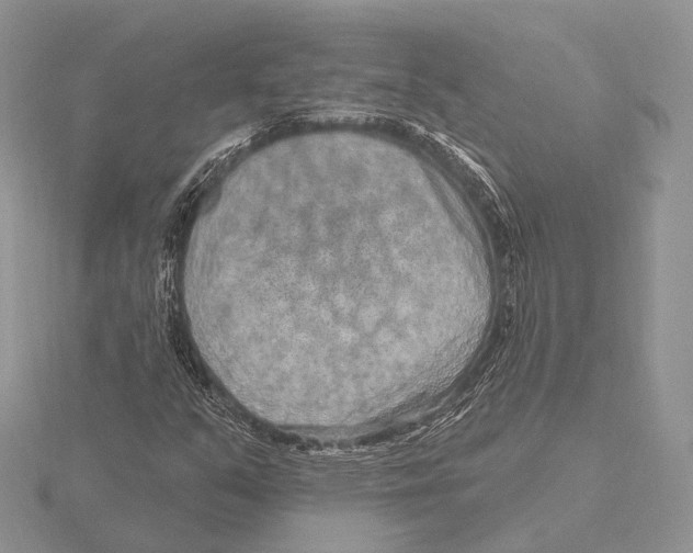 X0000115631351200912081035