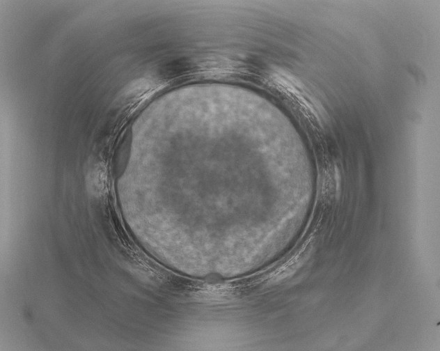 X0000115631353200912081035