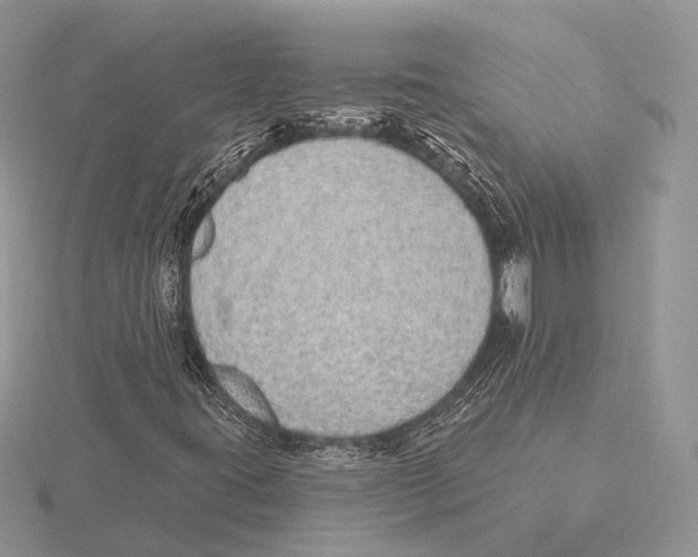 X0000115631395200912081034