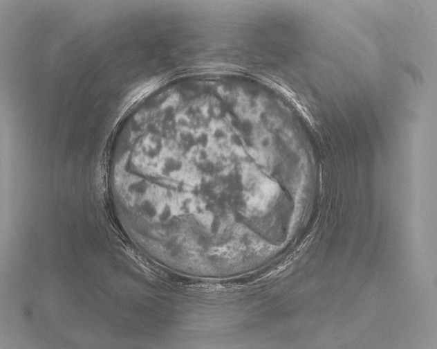 X0000115631405200912081034