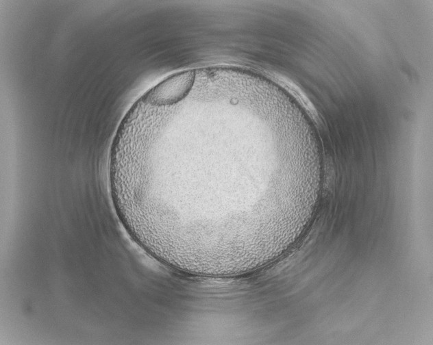 X0000115631439200912081034