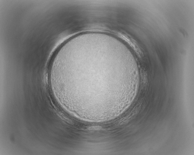 X0000115631462200912081033