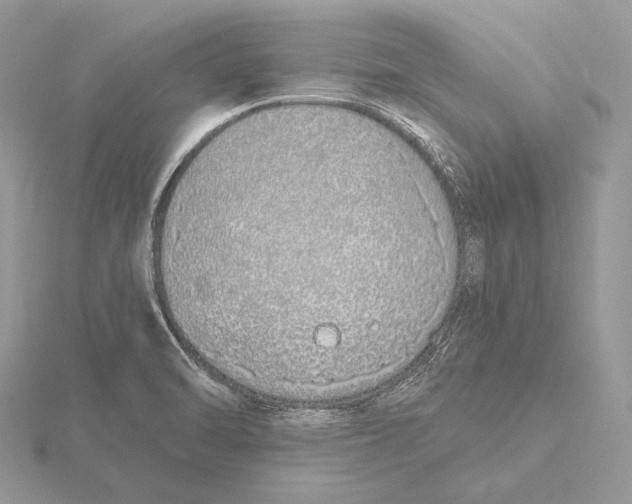 X0000115631470200912081033