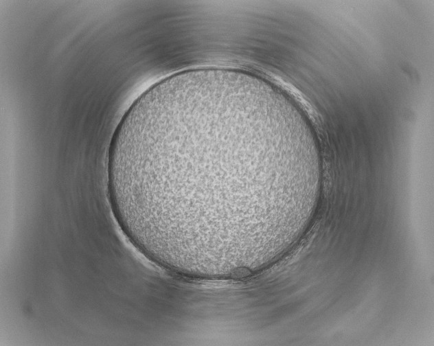 X0000115631479200912081033