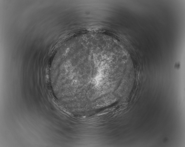 X0000115631106200912221243