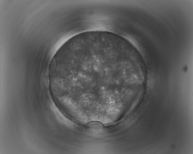 X0000115631468200912221239