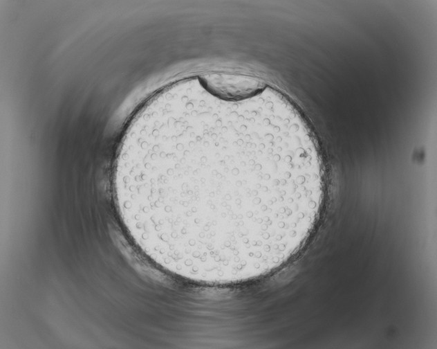 X0000115631499200912221238