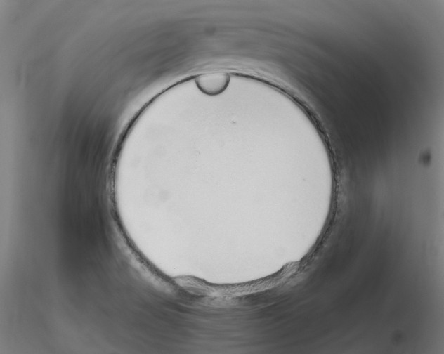 X0000115631517200912221238