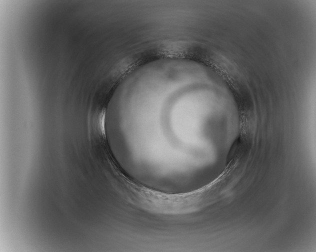 X0000115640047200911171431