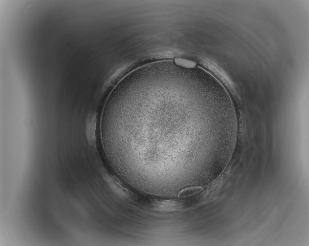 X0000115640058200911171430