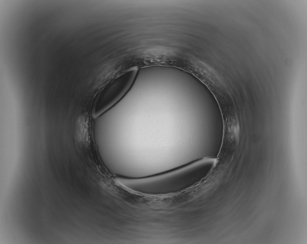 X0000115641060200911171418