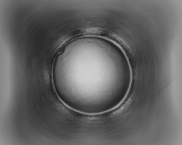 X0000115641401200911171413