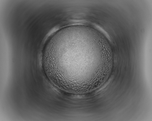 X0000115641411200911171413