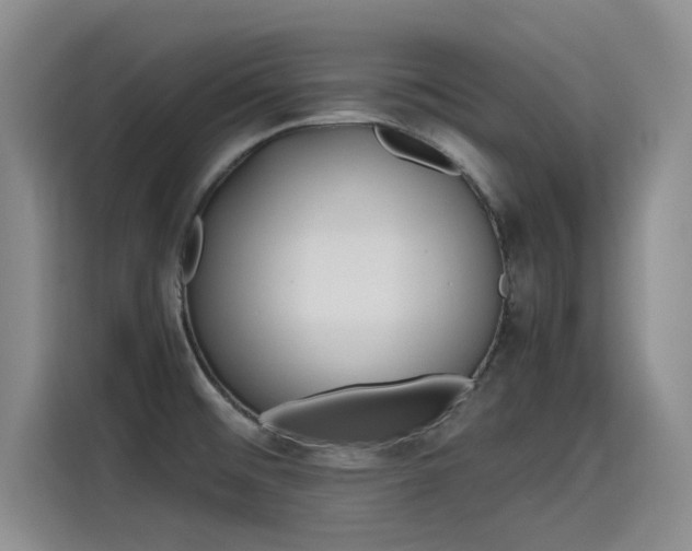 X0000115641476200911171412