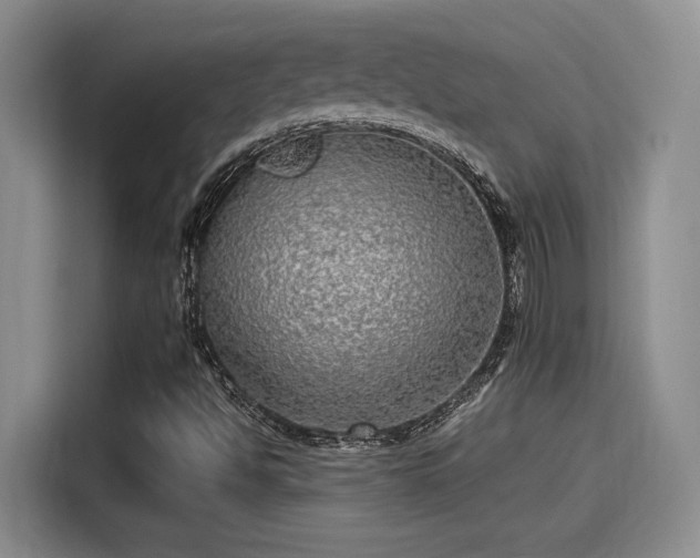 X0000115641494200911171411
