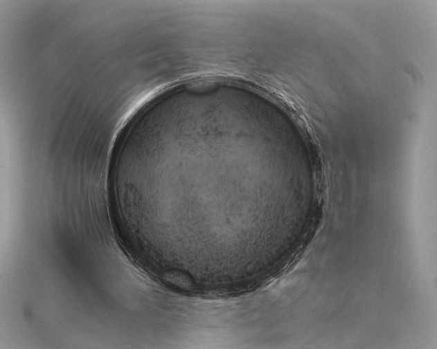 X0000115640196200912011508