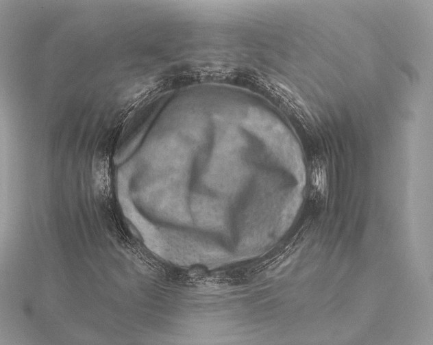 X0000115641252200912011454