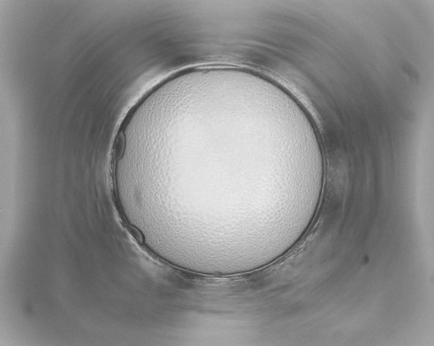 X0000115641485200912011451