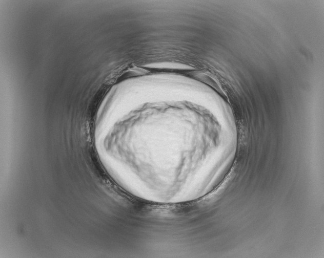 X0000115640182200912081112