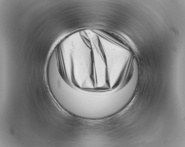 X0000115641196200912081058