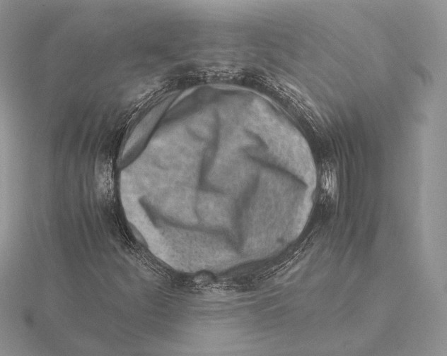 X0000115641252200912081057