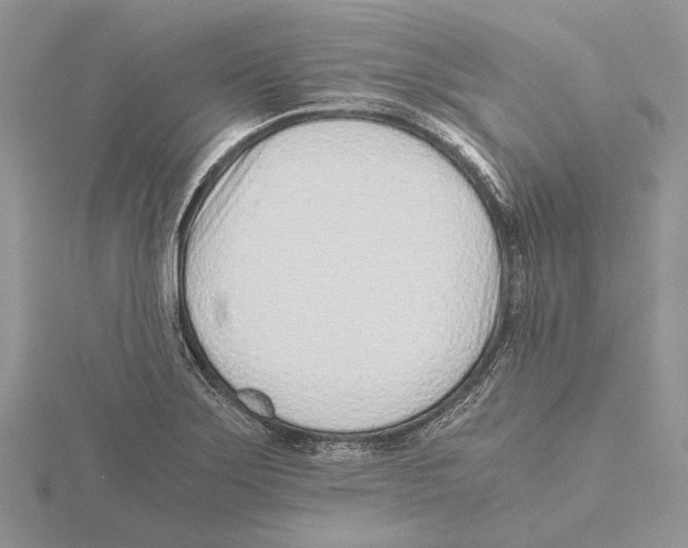 X0000115641275200912081057