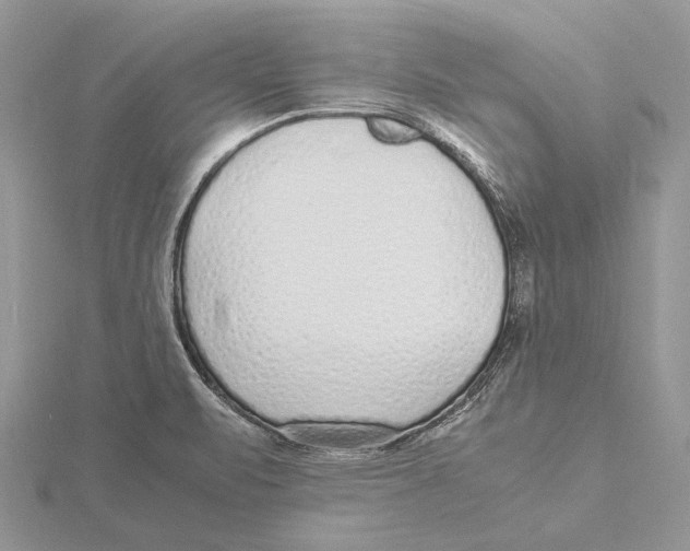 X0000115641471200912081054