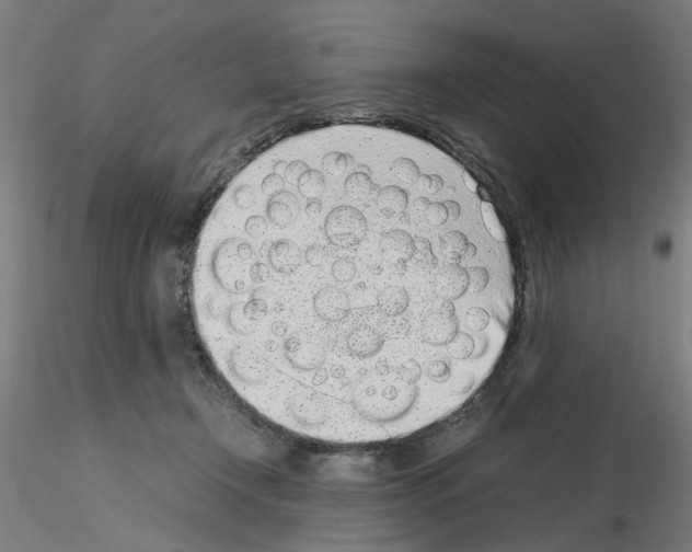 X0000115640366200912221315