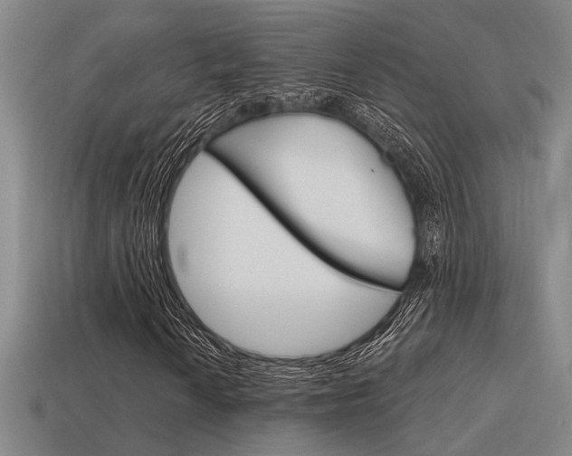X0000115651010200911101112