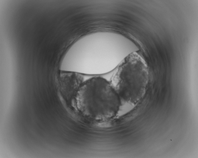 X0000115650353200911171447