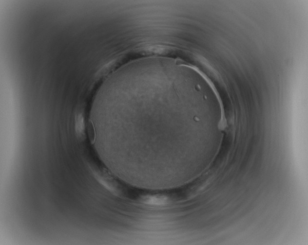 X0000115650500200911171445