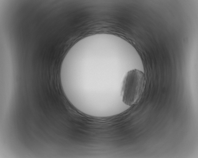 X0000115650570200911171445