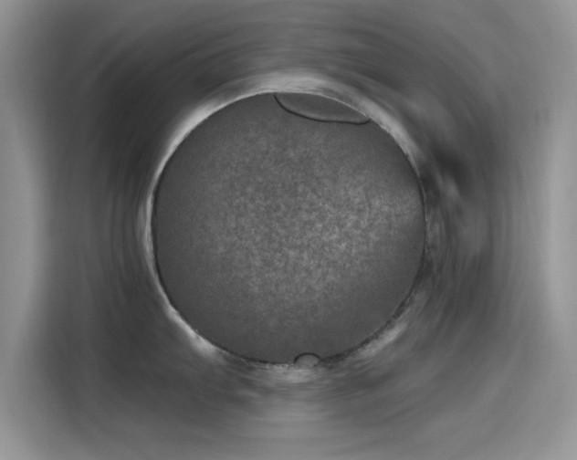 X0000115651103200911171437