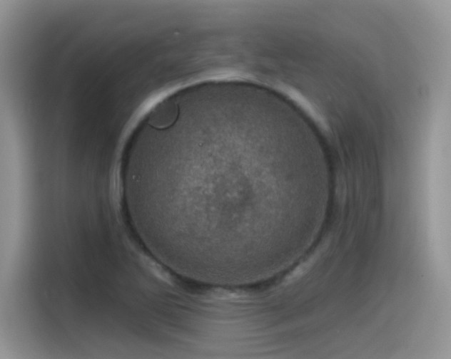 X0000115651270200911171435