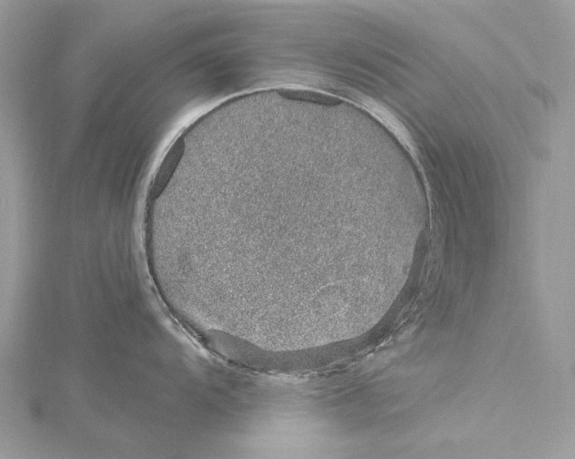 X0000115651104200912011517