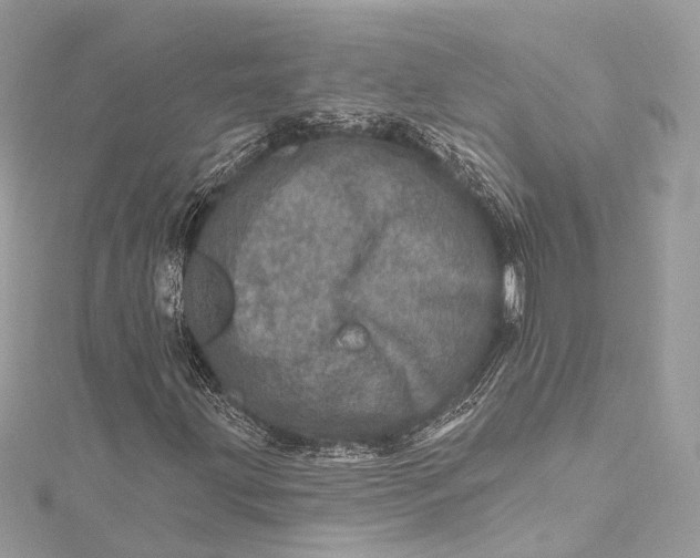 X0000115651203200912011515