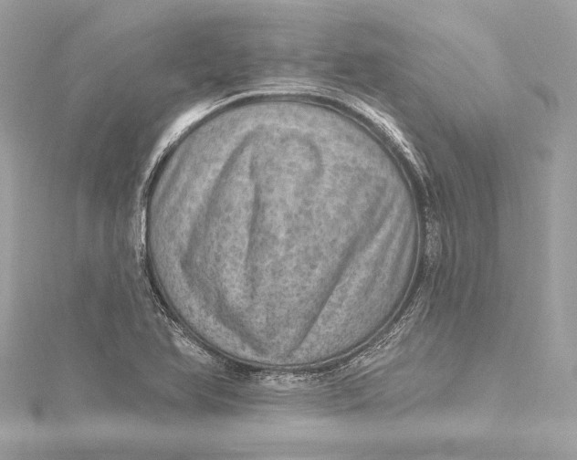 X0000115651366200912011513