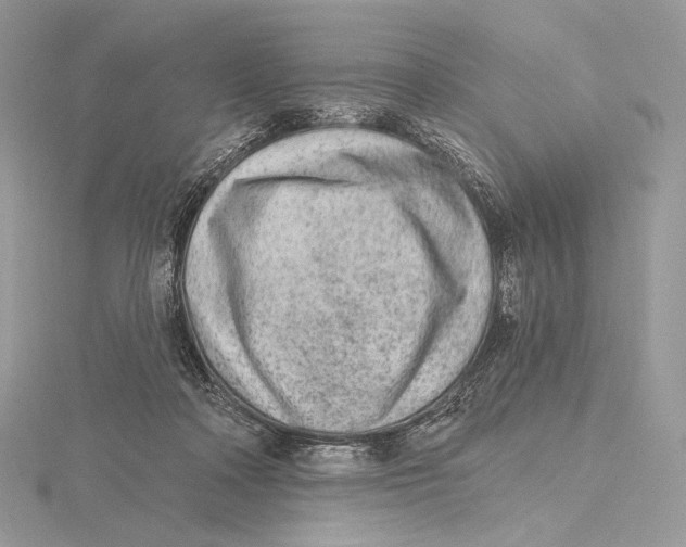 X0000115650314200912081130